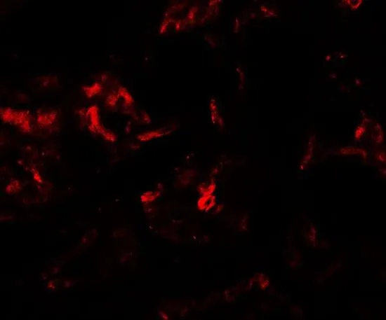 IHC-P analysis of human kidney tissue using GTX32097 PLA1A antibody. Working concentration : 20 microg/ml IHC-P analysis of human kidney tissue using GTX32097 PLA1A antibody. Working concentration : 20 microg/ml