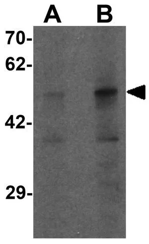 WB analysis of human kidney tissue lysate using GTX32097 PLA1A antibody. Working concentration : (A) 1 and (B) 2 microg/ml