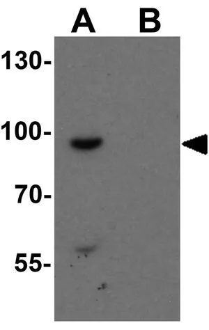 WB analysis of mouse heart tissue lysate in (A) the absence and (B) the presence of blocking peptide using GTX32098 SHROOM1 antibody. Working concentration : 1 microg/ml WB analysis of mouse heart tissue lysate in (A) the absence and (B) the presence of blocking peptide using GTX32098 SHROOM1 antibody. Working concentration : 1 microg/ml