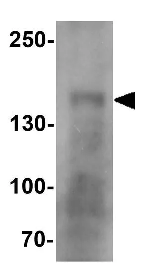 WB analysis of human small intestine tissue lysate using GTX32103 CRB1 antibody. Working concentration : 1 microg/ml WB analysis of human small intestine tissue lysate using GTX32103 CRB1 antibody. Working concentration : 1 microg/ml