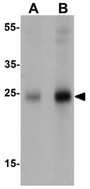 WB analysis of human brain tissue lysate using GTX32110 SHISA4 antibody. Working concentration : (A) 1 and (B) 2 microg/ml