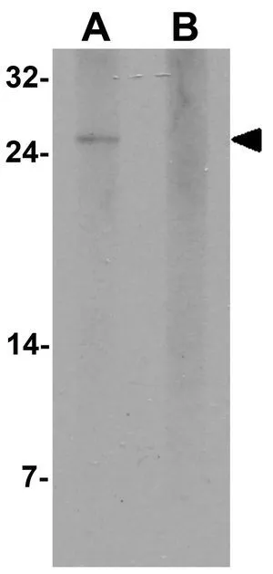 WB analysis of human brain tissue lysate in (A) the absence and (B) the presence of blocking peptide using GTX32111 MOSPD1 antibody. Working concentration : 1 microg/ml