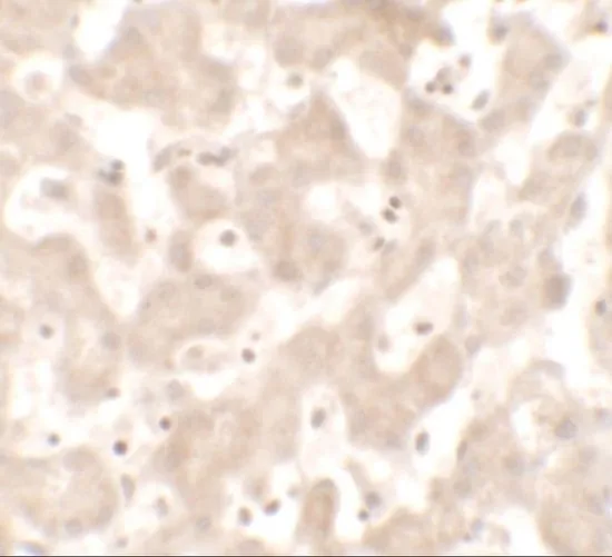 IHC-P analysis of human liver tissue using GTX32118 KHDC1 antibody. Working concentration : 5 microg/ml IHC-P analysis of human liver tissue using GTX32118 KHDC1 antibody. Working concentration : 5 microg/ml