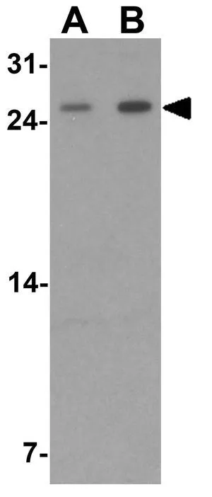 WB analysis of rat liver tissue lysate using GTX32118 KHDC1 antibody. Working concentration : (A) 0.5 and (B) 1 microg/ml