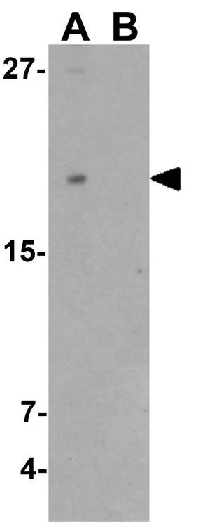 WB analysis of THP-1 cell lysate in (A) the absence and (B) the presence of blocking peptide using GTX32119 TMEM107 antibody. Working concentration : 1 microg/ml