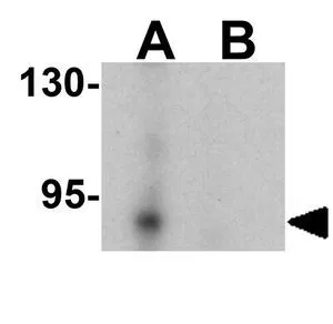 WB analysis of K562 cell lysate in (A) the absence and (B) the presence of blocking peptide using GTX32122 KDM1B / AOF1 antibody. Working concentration : 0.5 ug/ml