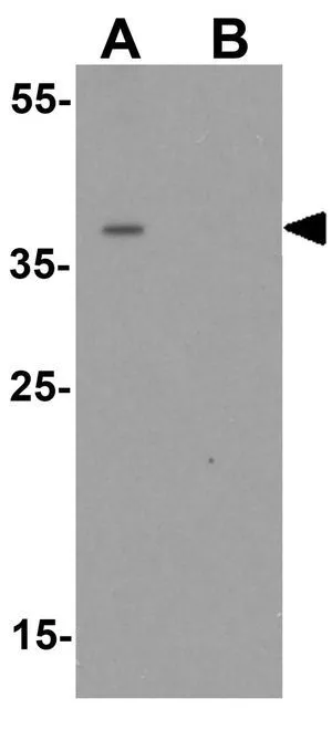 WB analysis of Jurkat cell lysate in (A) the absence and (B) the presence of blocking peptide using GTX32123 ZNF821 antibody. Working concentration : 0.5 microg/ml WB analysis of Jurkat cell lysate in (A) the absence and (B) the presence of blocking peptide using GTX32123 ZNF821 antibody. Working concentration : 0.5 microg/ml