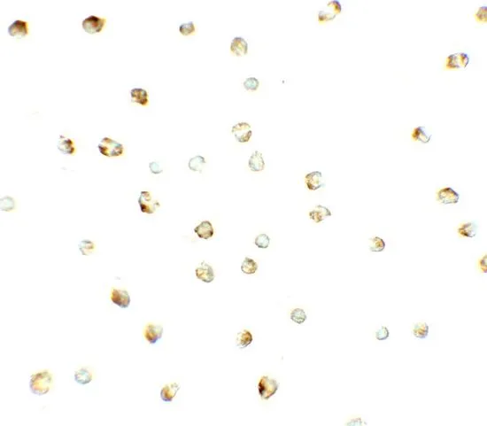 ICC/IF analysis of Jurkat cells using GTX32123 ZNF821 antibody. Working concentration : 2.5 microg/ml