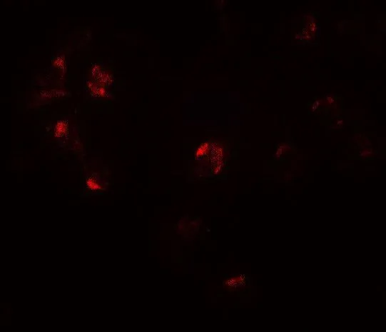 ICC/IF analysis of Jurkat cells using GTX32123 ZNF821 antibody. Working concentration : 20 microg/ml