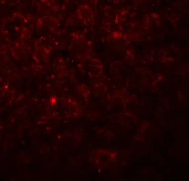 IHC-P analysis of rat liver tissue using GTX32128 C19orf80 antibody. Dilution : 20 microg/ml