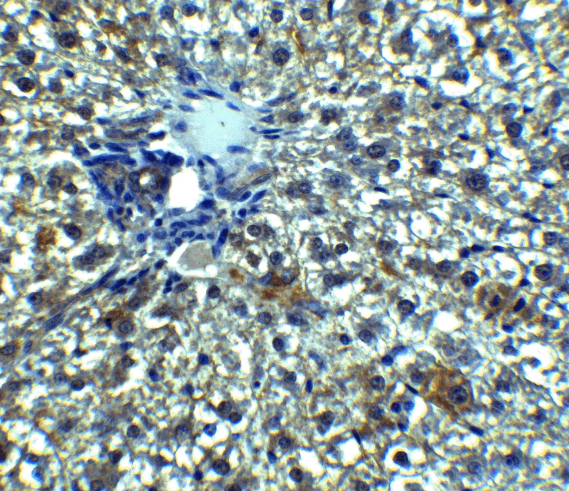 IHC-P analysis of rat liver tissue using GTX32128 C19orf80 antibody. Dilution : 5 microg/ml