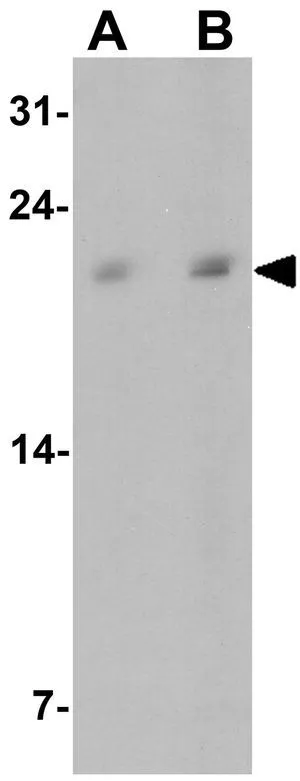 WB analysis of rat liver tissue lysate using GTX32128 C19orf80 antibody. Working concentration : (A) 1 and (B) 2 microg/ml