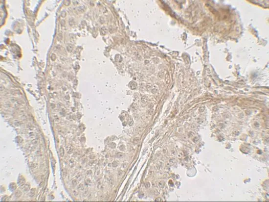 IHC-P analysis of human testis tissue using GTX32129 GLIPR1L2 antibody. Working concentration : 5 microg/ml IHC-P analysis of human testis tissue using GTX32129 GLIPR1L2 antibody. Working concentration : 5 microg/ml