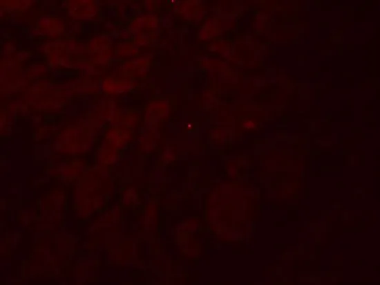 IHC-P analysis of human testis tissue using GTX32129 GLIPR1L2 antibody. Working concentration : 20 microg/ml