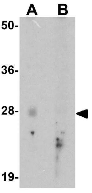 WB analysis of human testis tissue lysate in (A) the absence and (B) the presence of blocking peptide using GTX32129 GLIPR1L2 antibody. Working concentration : 1 microg/ml