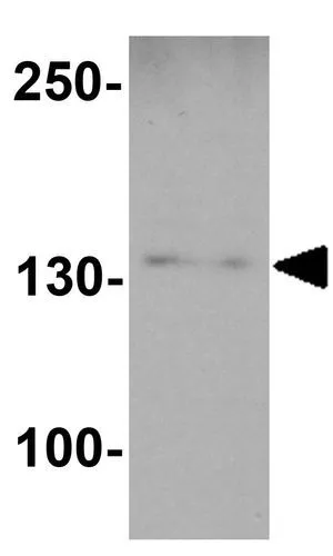 WB analysis of Jurkat cell lysate in (A) the absence and (B) the presence of blocking peptide using GTX32141 Beclin 2 antibody. Working concentration : 1 microg/ml