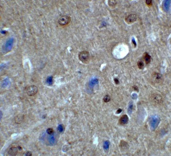 IHC-P analysis of mouse brain tissue using GTX32158 PACS1 antibody. Working concentration : 2 microg/ml