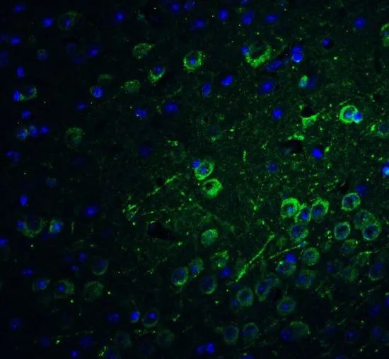IHC-P analysis of mouse brain tissue using GTX32158 PACS1 antibody. Working concentration : 20 microg/ml