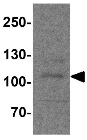 WB analysis of rat bladder tissue lysate using GTX32158 PACS1 antibody. Working concentration : 1 microg/ml