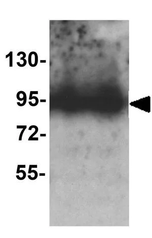 WB analysis of rat liver tissue lysate using GTX32161 Trophinin antibody. Working concentration : 1 microg/ml