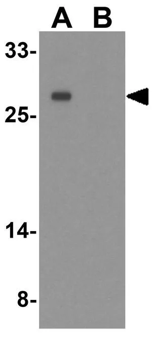 WB analysis of A549 cell lysate in (A) the absence and (B) the presence of blocking peptide using GTX32162 PMEPA1 antibody. Working concentration : 1 microg/ml