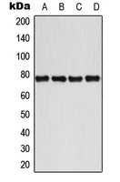 WB analysis of IL1b-treated MCF7 (A), CD3-treated Jurkat (B), IL1b-treated Raw264.7 (C), IL1b-treated H9C2 (D) whole cell lysates using GTX32164 BMX (phospho Tyr40) antibody. WB analysis of IL1b-treated MCF7 (A), CD3-treated Jurkat (B), IL1b-treated Raw264.7 (C), IL1b-treated H9C2 (D) whole cell lysates using GTX32164 BMX (phospho Tyr40) antibody.