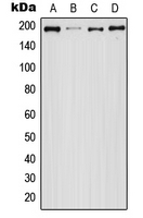 WB analysis of HEK293T (A), EGF-treated A431 (B), Raw264.7 (C), PC12 (D) whole cell lysates using GTX32174 EGFR (phospho Ser1047) antibody. WB analysis of HEK293T (A), EGF-treated A431 (B), Raw264.7 (C), PC12 (D) whole cell lysates using GTX32174 EGFR (phospho Ser1047) antibody.