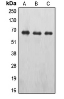 WB analysis of A498 (A), pervanadate-treated MCF7 (B), NIH3T3 (C) whole cell lysates using GTX32177 EPO receptor (phospho Tyr426) antibody. WB analysis of A498 (A), pervanadate-treated MCF7 (B), NIH3T3 (C) whole cell lysates using GTX32177 EPO receptor (phospho Tyr426) antibody.