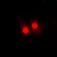 ICC/IF analysis of formalin-fixed HepG2 cells using GTX32179 FANCA (phospho Ser1149) antibody. Red : Primary antibody Blue : DAPI Permeabilization : 0.1% Triton X-100 in TBS for 5-10 minutes ICC/IF analysis of formalin-fixed HepG2 cells using GTX32179 FANCA (phospho Ser1149) antibody. Red : Primary antibody Blue : DAPI Permeabilization : 0.1% Triton X-100 in TBS for 5-10 minutes