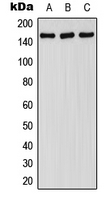 WB analysis of EGF-treated HepG2 (A), EGF-treated SP2/0 (B), EGF-treated H9C2 (C) whole cell lysates using GTX32179 FANCA (phospho Ser1149) antibody.