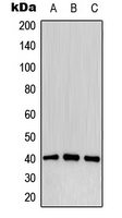 WB analysis of pervanadate-treated MCF7 (A), mouse liver (B), pervanadate-treated PC12 (C) whole cell lysates using GTX32180 CD32B (phospho Tyr292) antibody. WB analysis of pervanadate-treated MCF7 (A), mouse liver (B), pervanadate-treated PC12 (C) whole cell lysates using GTX32180 CD32B (phospho Tyr292) antibody.