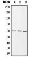 WB analysis of insulin-treated HEK293T (A), mouse spleen (B), insulin-treated PC12 (C) whole cell lysates using GTX32187 GRB10 (phospho Tyr67) antibody.