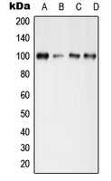 WB analysis of Forskonlin-treated MCF7 (A), mouse brain (B), mouse spleen (C), rat spleen (D) whole cell lysates using GTX32189 GluR4 (phospho Ser862) antibody. WB analysis of Forskonlin-treated MCF7 (A), mouse brain (B), mouse spleen (C), rat spleen (D) whole cell lysates using GTX32189 GluR4 (phospho Ser862) antibody.