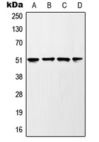 WB analysis of UV-treated HEK293T (A),mouse liver (B),rat liver (C),H2O2-treated PC12 (D) whole cell lysates using GTX32191 GSK3 alpha (phospho Ser21) antibody.