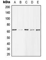 WB analysis of EGF-treated MCF7 (A), Jurkat (B), NIH3T3 (C), mouse spleen (D), EGF-treated H9C2 (E) whole cell lysates using GTX32193 HDAC1 (phospho Ser421) antibody. WB analysis of EGF-treated MCF7 (A), Jurkat (B), NIH3T3 (C), mouse spleen (D), EGF-treated H9C2 (E) whole cell lysates using GTX32193 HDAC1 (phospho Ser421) antibody.