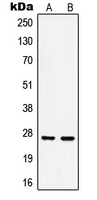 WB analysis of Anisomycin-treated HeLa (A), MCF7 (B) whole cell lysates using GTX32195 HSP27 (phospho Ser15) antibody.