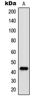 WB analysis of Anisomycin-treated NIH3T3 (A) whole cell lysates using GTX32204 c-Jun (phospho Thr91) antibody.