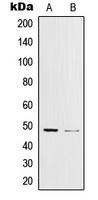 WB analysis of UV-treated K562 (A), Anisomycin-treated HeLa (B) whole cell lysates using GTX32205 c-Jun (phospho Tyr170) antibody.