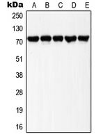 WB analysis of UV-treated HeLa (A), UV-treated Raw264.7 (B), A431 (C), NIH3T3 (D), PC12 (E) whole cell lysates using GTX32211 LIMK1 (phospho Thr508)? + LIMK2 (phospho Thr505) antibody. WB analysis of UV-treated HeLa (A), UV-treated Raw264.7 (B), A431 (C), NIH3T3 (D), PC12 (E) whole cell lysates using GTX32211 LIMK1 (phospho Thr508)? + LIMK2 (phospho Thr505) antibody.