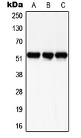 WB analysis of UV-treated HeLa (A), UV-treated SP2/0 (B), UV-treated H9C2 (C) whole cell lysates using GTX32214 SMAD3 (phospho Ser204) antibody.
