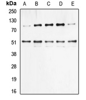 WB analysis of HeLa (A), TNF-treated HEK293T (B), NIH3T3 (C), Raw264.7 (D), rat liver (E) whole cell lysates using GTX32223 NFkB p105/p50 (phospho Ser337) antibody.