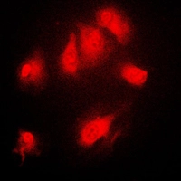ICC/IF analysis of formalin-fixed Raw264.7 cells using GTX32224 IKB alpha (phospho Ser32/Ser36) antibody. Red : Primary antibody Blue : DAPI Permeabilization : 0.1% Triton X-100 in TBS for 5-10 minutes ICC/IF analysis of formalin-fixed Raw264.7 cells using GTX32224 IKB alpha (phospho Ser32/Ser36) antibody. Red : Primary antibody Blue : DAPI Permeabilization : 0.1% Triton X-100 in TBS for 5-10 minutes