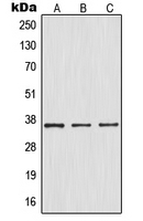 WB analysis of TNFa-treated HepG2 (A), TNFa-treated Raw264.7 (B), TNFa-treated PC12 (C) whole cell lysates using GTX32224 IKB alpha (phospho Ser32/Ser36) antibody.
