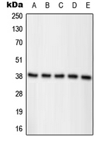 WB analysis of colchicine-treated MCF7 (A), LNCaP (B), HeLa (C), colchicine-treated Raw264.7 (D), colchicine-treated PC12 (E) whole cell lysates using GTX32229 Nucleophosmin (phospho Thr234) antibody. WB analysis of colchicine-treated MCF7 (A), LNCaP (B), HeLa (C), colchicine-treated Raw264.7 (D), colchicine-treated PC12 (E) whole cell lysates using GTX32229 Nucleophosmin (phospho Thr234) antibody.