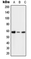 WB analysis of H2O2-treated HeLa (A),H2O2-treated SP2/0 (B),H2O2-treated H9C2 (C) whole cell lysates using GTX32234 PFKFB2 (phospho Ser483) antibody.
