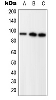 WB analysis of EGF-treated HEK293T (A), EGF-treated SP2/0 (B), PMA-treated PC12 (C) whole cell lysates using GTX32235 Progesterone Receptor (phospho Ser294) antibody. WB analysis of EGF-treated HEK293T (A), EGF-treated SP2/0 (B), PMA-treated PC12 (C) whole cell lysates using GTX32235 Progesterone Receptor (phospho Ser294) antibody.