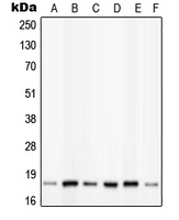 WB analysis of insulin-treated HeLa (A),K562 (B),NIH3T3 (C),insulin-treated Raw264.7 (D),insulin-treated PC12 (E),calyculin A-treated C6 (F) whole cell lysates using GTX32236 PIN1 (phospho Ser16) antibody.