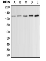 WB analysis of HeLa (A), Jurkat (B), PMA-treated HEK293T (C), PDGF-treated NIH3T3 (D), PMA-treated H9C2 (E) whole cell lysates using GTX32245 PKC mu (phospho Ser910) antibody. WB analysis of HeLa (A), Jurkat (B), PMA-treated HEK293T (C), PDGF-treated NIH3T3 (D), PMA-treated H9C2 (E) whole cell lysates using GTX32245 PKC mu (phospho Ser910) antibody.