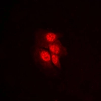 ICC/IF analysis of formalin-fixed HeLa cells using GTX32249 MEK1 (phospho Thr292) antibody. Red : Primary antibody Blue : DAPI Permeabilization : 0.1% Triton X-100 in TBS for 5-10 minutes ICC/IF analysis of formalin-fixed HeLa cells using GTX32249 MEK1 (phospho Thr292) antibody. Red : Primary antibody Blue : DAPI Permeabilization : 0.1% Triton X-100 in TBS for 5-10 minutes
