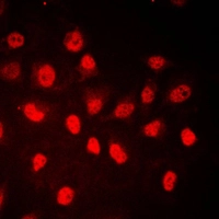 ICC/IF analysis of formalin-fixed HeLa cells using GTX32254 Rb (phospho Ser780) antibody. Red : Primary antibody Blue : DAPI Permeabilization : 0.1% Triton X-100 in TBS for 5-10 minutes ICC/IF analysis of formalin-fixed HeLa cells using GTX32254 Rb (phospho Ser780) antibody. Red : Primary antibody Blue : DAPI Permeabilization : 0.1% Triton X-100 in TBS for 5-10 minutes
